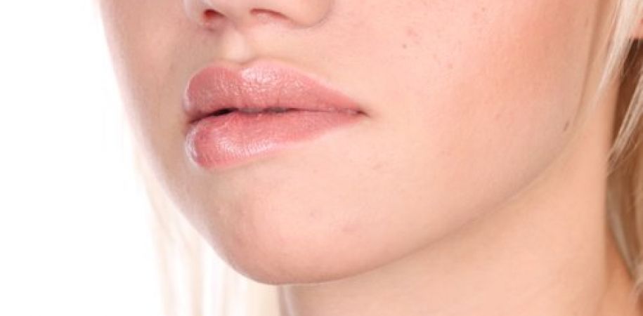 Labbra secche e screpolate: rimedi naturali 